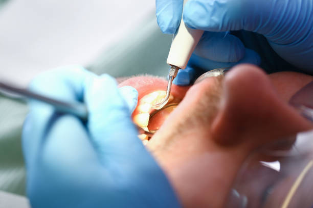 Best Emergency Root Canal Treatment in White Hall, AR