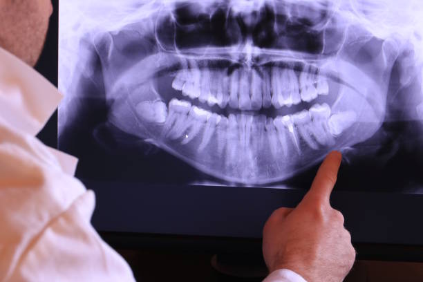 Best Emergency Dental Surgery in White Hall, AR