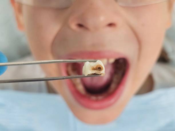 Best Pediatric Emergency Dentist in White Hall, AR