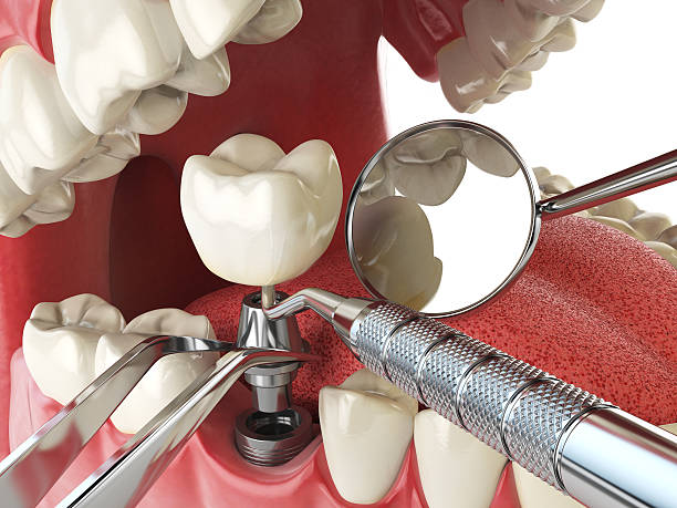 Best Emergency Dental Care for Trauma or Injury in White Hall, AR