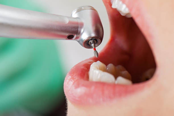 Best Same-Day Emergency Dentist in White Hall, AR